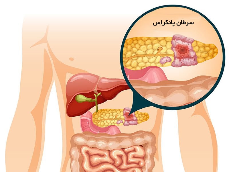 آسان درمان