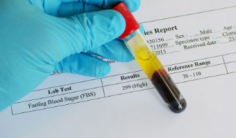 آزمایش قند خون چیست و چرا ضروری است؟