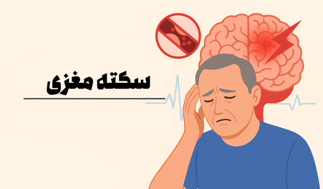 علائم اولیه سکته مغزی و اقدامات فوری در منزل