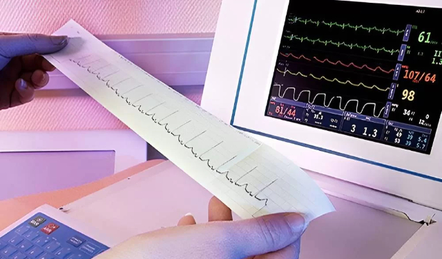 نوار قلب چگونه کار می‌کند؟ آشنایی با مفهوم امواج ECG