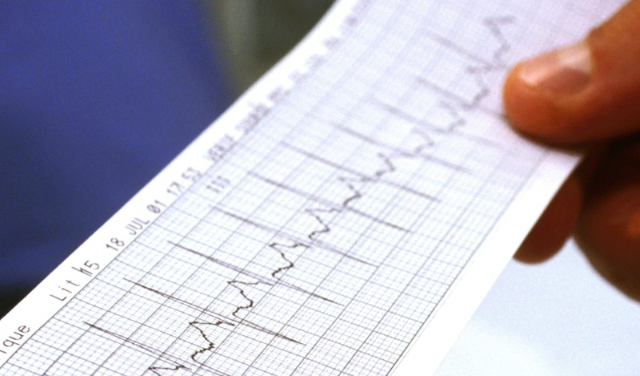 آرامش خانواده با خدمات نوار قلب خانگی؛ امنیت در کنار سلامت