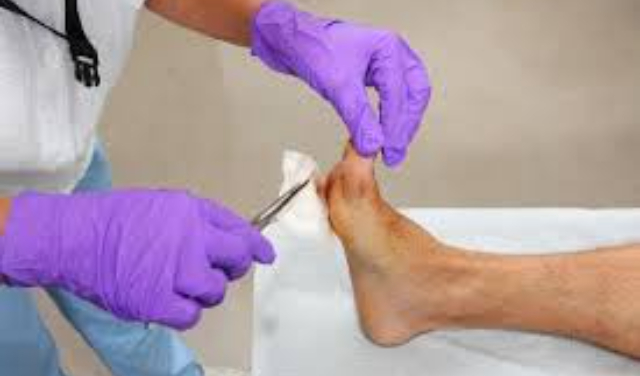 پانسمان زخم دیابتی در منزل؛ چرا درمان تخصصی اهمیت دارد؟