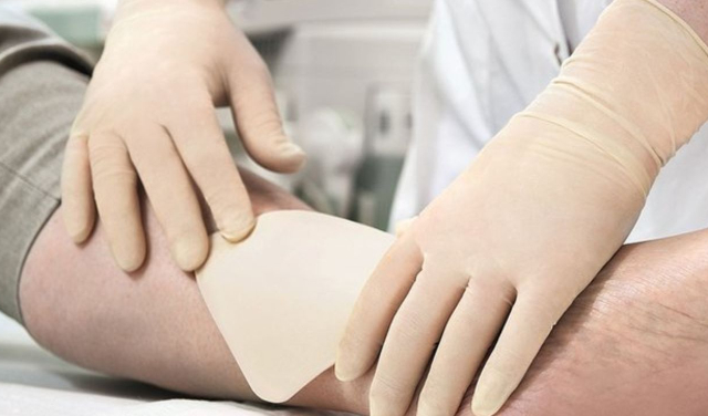 استفاده از پانسمان‌های نوین در درمان زخم در منزل