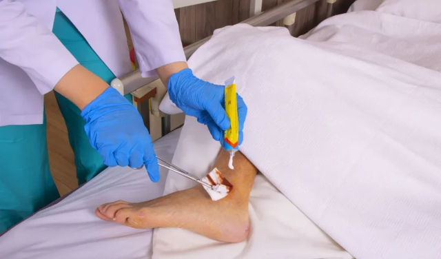 چه زخم‌هایی را می‌توان در منزل درمان کرد و چه زخم‌هایی نیاز به پرستار دارند؟